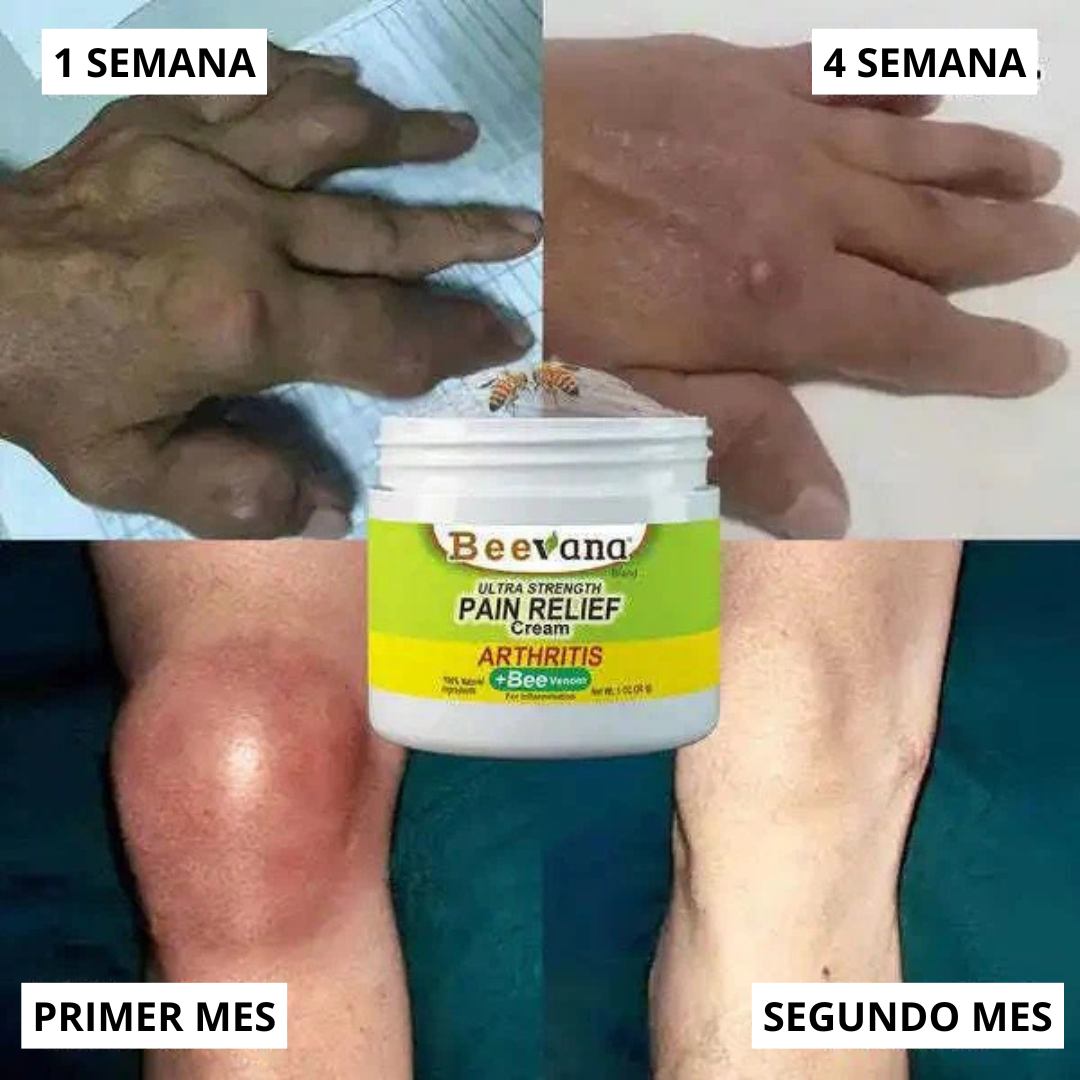 Compre 2 y llévese 4 - BeeVana™ crema dolores y articulaciones - TRATAMIENTO COMPLETO